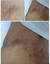 Shin's burned back